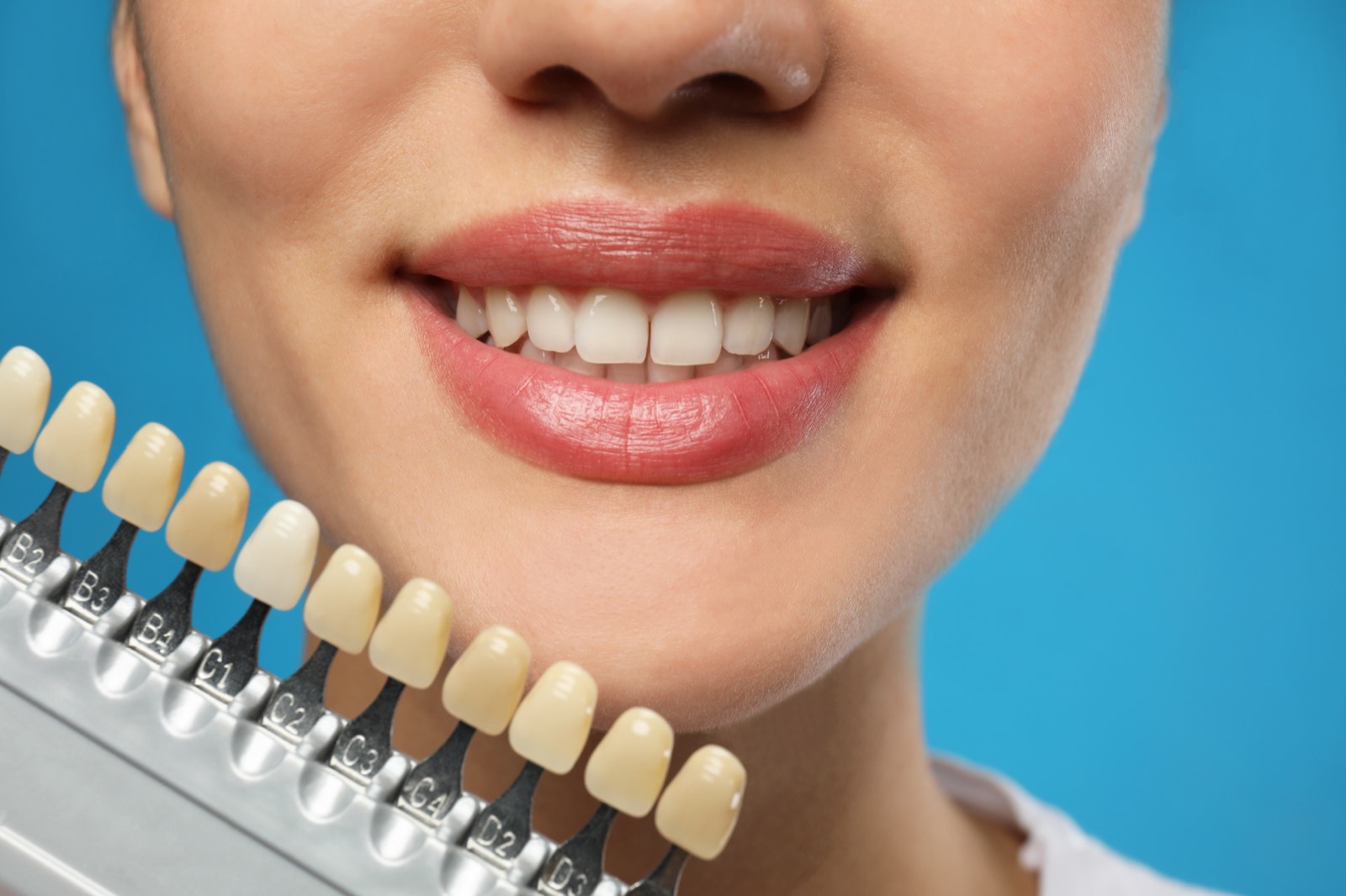 Close-up of a bright smile beside a tooth shade guide