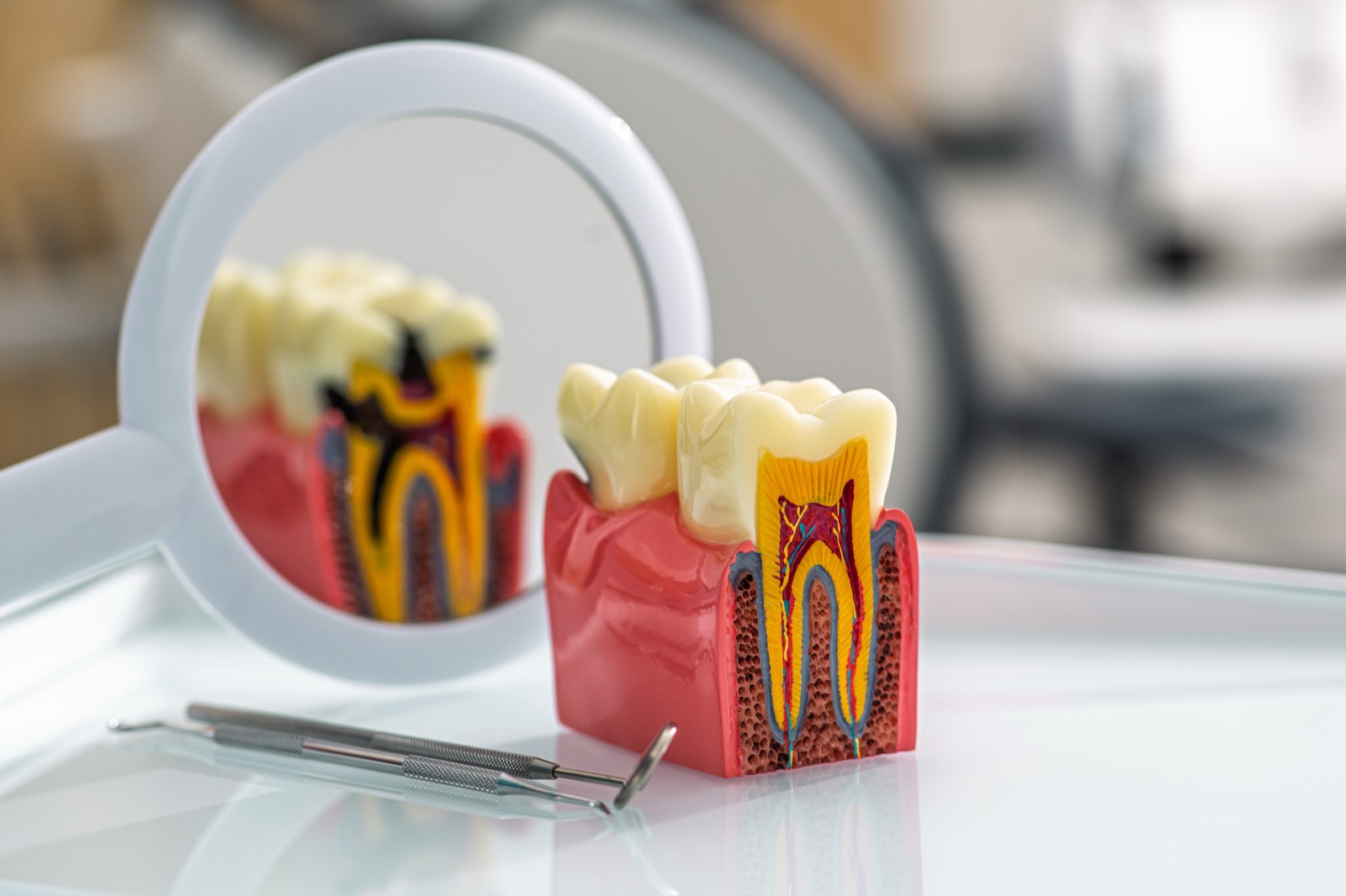 Cross-section dental model showing tooth roots, gums, and bone