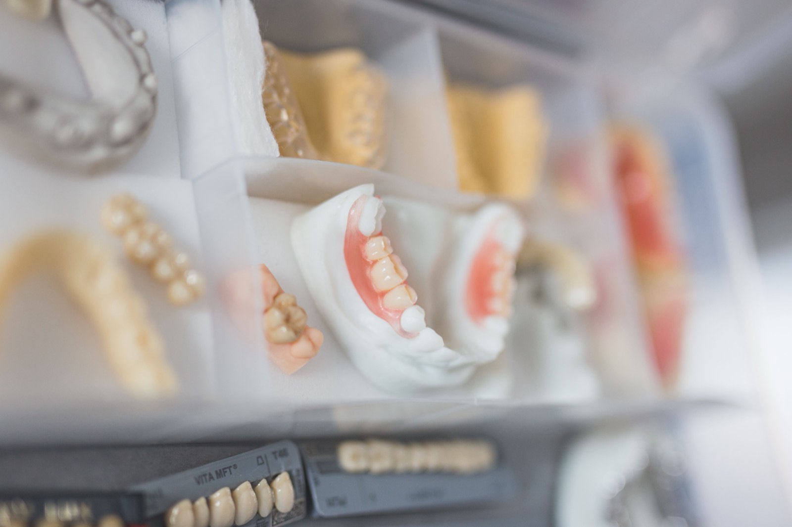 Crowns, bridges, and dentures arranged in a dental lab case